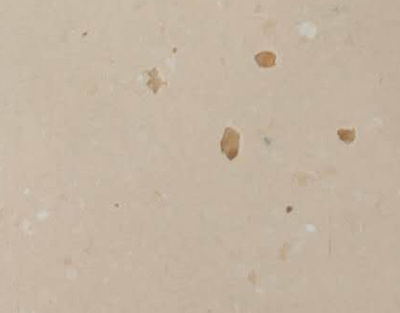 布莱顿-优瑞系列2